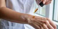Cara Menggunakan Propolis untuk Kulit Gatal yang Tepat dan Aman