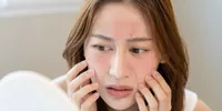 Kulit Wajah Mendadak Rewel? Kenali Tanda Skin Barrier Rusak dan Cara Ampuh Mengatasinya