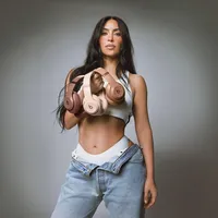 Kim Kardashian Didiagnosis Aneurisma Otak, Stres jadi Pemicu