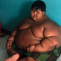 Masih Ingat Bocah 192 Kg Arya Permana? ini Kabarnya Sekarang