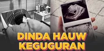 Dinda Hauw Ceritakan Kronologi Keguguran Bayi Kembar