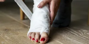 10 Cara Menghilangkan Bekas Luka yang Menghitam, Secara Alami dan Cepat