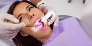 11 Cara Membersihkan Karang Gigi Secara Alami, Ampuh dan Bisa Dilakukan di Rumah