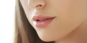 12 Cara Mengatasi Bibir Kering dan Pecah-pecah Menggunakan Bahan Alami