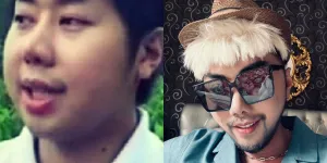 13 Transformasi Artis yang Lakukan Treatment Dagu Lancip, Before Afternya Bikin Kaget