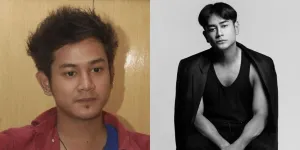 15 Transformasi Artis Sebelum dan Sesudah Suntik Botoks, Ada yang Menolak Tua