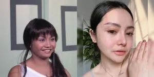 16 Transformasi Artis Sebelum dan Sesudah Operasi Hidung, Ada yang Sampai Ketagihan