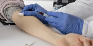 4 Cara Mengetahui Golongan Darah, Bisa Dilihat dari Kondisi Fisik