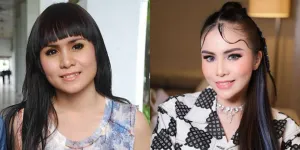 6 Potret Seleb Sebelum dan Sesudah Hilangkan Gigi Gingsul, Lebih Cocok Mana?