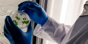 8 Jenis Bakteri yang Menyerang Tubuh, Sebabkan Penyakit Berbahaya