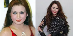 9 Transformasi Artis Sebelum dan Sesudah Lakukan Face Lifting, Langsung Kembali Muda