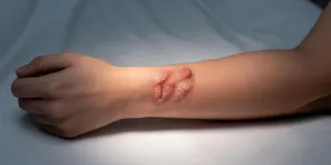 Arti Mimpi Digigit Manusia: Makna dan Interpretasi Lengkap