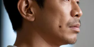 Arti Tahi Lalat di Jakun: Makna dan Kepercayaan yang Perlu Diketahui