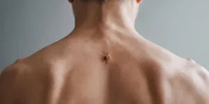 Arti Tahi Lalat di Tulang Belakang: Makna dan Kepercayaan Tradisional