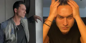 Buka Suara Soal Oplas, Indra Bruggman: Langkah Terakhir yang Harus Dilakukan