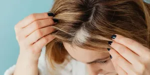 Cara Mengatasi Rambut Pitak dengan Trik Makeup Sederhana, Auto Percaya Diri