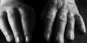 Cara Menghaluskan Kulit Tangan Keriput, Ampuh dengan Bahan Alami