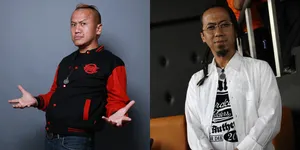 Meski Patah Kaki, Yukie Pas Band Tetap Manggung Pakai Tongkat