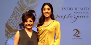 Imbangi Kegiatan Outdoor, Widy Vierratale Jalani Botox Hingga Tanam Benang