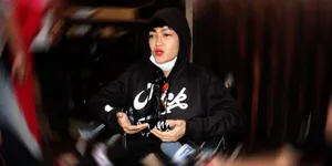 Kena Efek Radiasi, Rambut Julia Perez Memutih