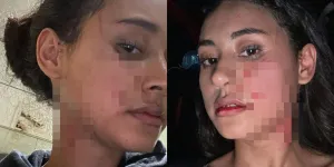 Kisah Pilu Afifah Riyad, Selebgram Indonesia yang Alami Kekerasan Fisik oleh Mantan Pacar Suami