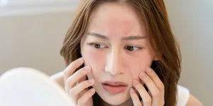 Kulit Wajah Mendadak Rewel? Kenali Tanda Skin Barrier Rusak dan Cara Ampuh Mengatasinya
