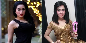 Mirip Syahrini, Penyanyi Ini Dapat Anugerah Sekaligus Musibah