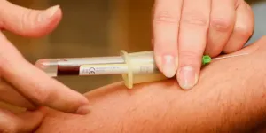 Mitos dan Fakta Seputar Kolesterol, Alasan Kenapa Orang Kurus Juga Perlu Waspada