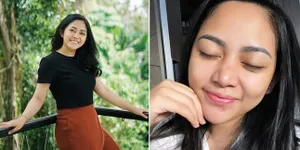 Rachel Vennya Akui Hubungannya Dengan Suami Ada Di Titik Terbawah