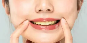 Rahasia Memutihkan Gigi Kuning, Garam dan Satu Bahan Ajaib Ini Wajib Kamu Coba