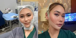 Rahasia Wajah Tirus dan Awet Muda Ala Inul Daratista, Threatment-nya Rutin Tanpa Oplas