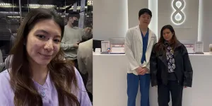 Shalom Razade Tunjukkan Detik-Detik Sebelum Operasi Hidung, Tegang Namun Tetap Tersenyum