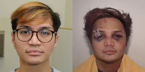 Viral Foto Reynhard Sinaga Babak Belur yang Dirilis Polisi, Korban Ceritakan Kembali Kisahnya