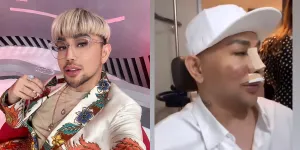 8 Potret Caren Delano yang Lakukan Oplas Hidung Karena Sulit Bernafas, Cuek Disebut Tak Syukuri Ciptaan Tuhan