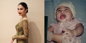  8 Potret Masa Kecil Azizah Salsha, Bikin Netizen Gemas Maksimal!