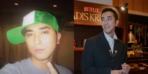 8 Potret Transformasi Winky Wiryawayn yang Disebut Seperti Vampir, Makin Tua Tambah Awet Muda