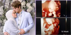 9 Potret Foto USG Anak Lesti dan Rizky Billar Terungkap, Wajah Leslar Junior Mirip Banget dengan Sang Ibu