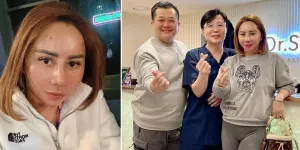 Akhirnya Lepas Masker, Intip Wajah Baru Femmy Permatasari Setelah Oplas Hidung dan Face Lift di Korea