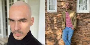 Bikin Pangling! 9 Potret Terbaru Atalarik Syach Tampil dengan Kepala Botak - Sempat Nggak Percaya Diri