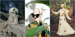 Bukan Manekin Atau Lukisan, Model Ini Alami Kelainan Langka!