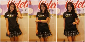 Cantik Bergigi Kelinci, Anisa Rahma Sempat Tak Percaya Diri