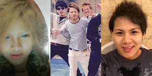 Cantik! Foto-Foto Evelyn Sebelum Suntik Hormon Bikin Tercengang