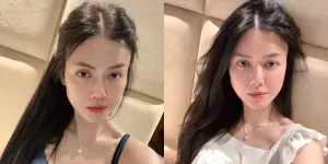 Cantiknya Natural, Ini Potret Nita Gunawan Percaya Diri Tampil Bare Face - Tetap Menawan Meski Wajah Berminyak