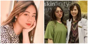 Cerita Mantan Kekasih Indra Kenz Habiskan Puluhan Juta Cuma Buat Perawatan Wajah, Demi Dapatkan Hasil Maksimal