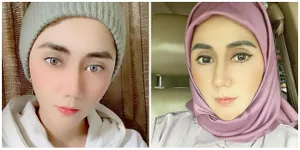 Cerita Sedih Aida Saskia yang Lawan Kanker Hingga Payudaranya Diangkat: Aku Banyak Mengabaikan Shalat