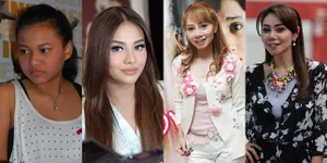 FOTO: Berubah Drastis-Makin Cantik, 12 Seleb Ini Operasi Plastik?