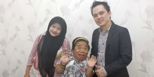 Foto-Foto Hendrik Ceper Ikutan Sulam Bibir Karena Ingin Ganteng