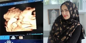 FOTO: Hamil Tua, Kadar Kolesterol Adelia Pasha Malah Tinggi