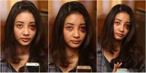 FOTO: Kronologi Pemukulan Saori Ishii, Mantan Model Asal Jepang