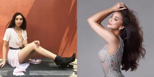 Manohara Kini Langsing & Miliki Kaki Jenjang Bak Model Papan Atas